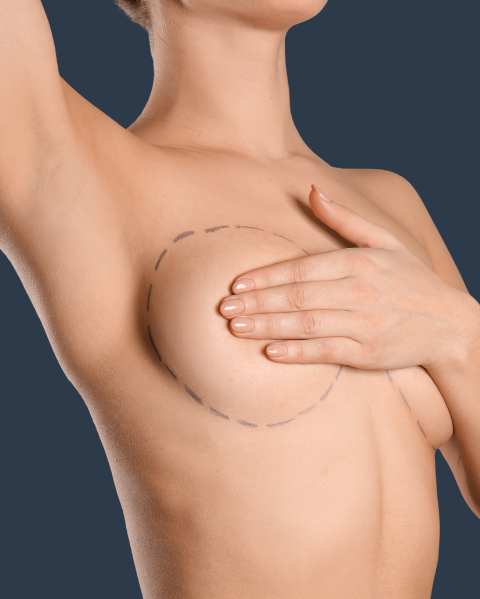 Breast Augmentation Surgery The Mere Hospital Cheshire Northwest