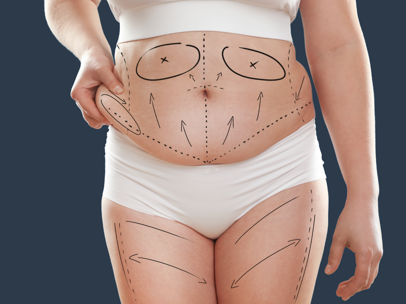 Liposuction Surgery The Mere Hospital Cheshire Northwest