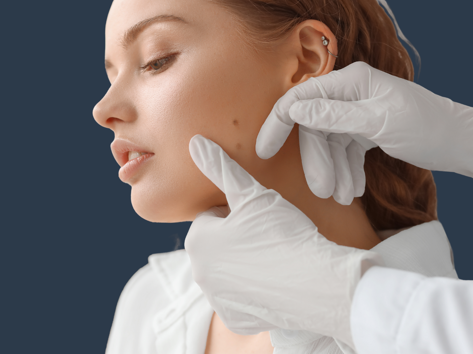 Mole Removal The Mere Hospital Cheshire Northwest